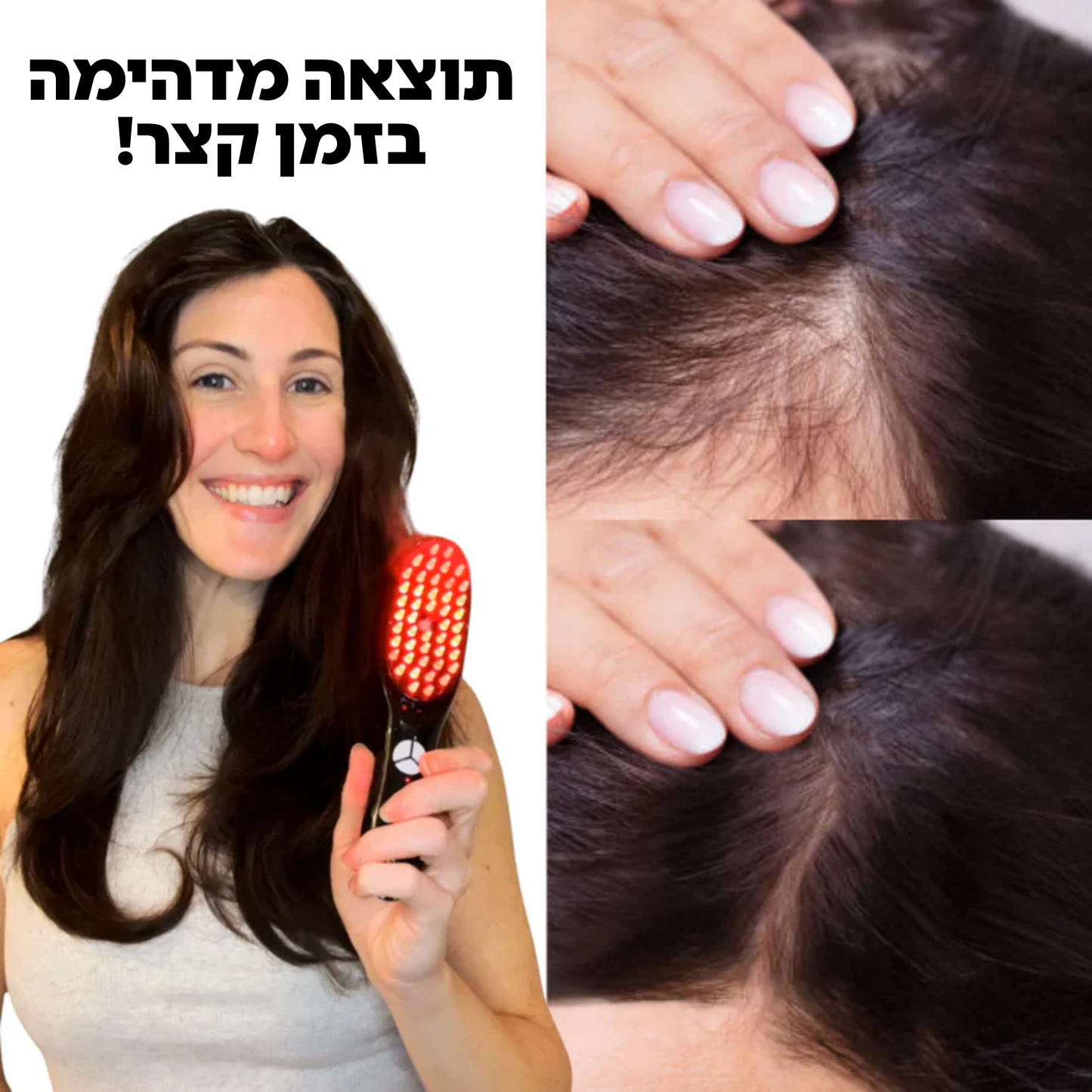 מברשת שיקום השיער המובילה בישראל I-Brush